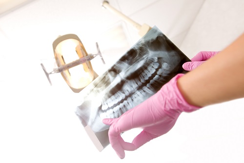 Dental X-ray in Joondalup